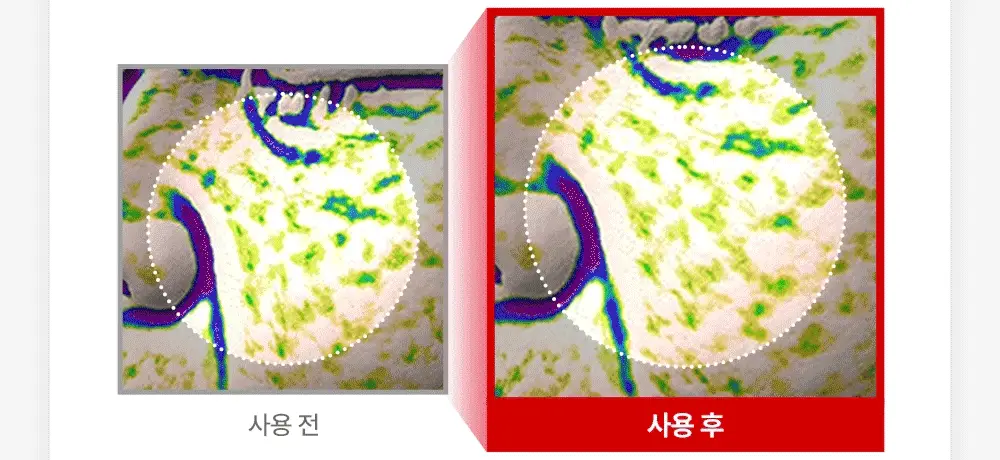 [원조랩핑] 메디필 랩핑 마스크 70ml 브러쉬 기획 세트 상세페이지 24